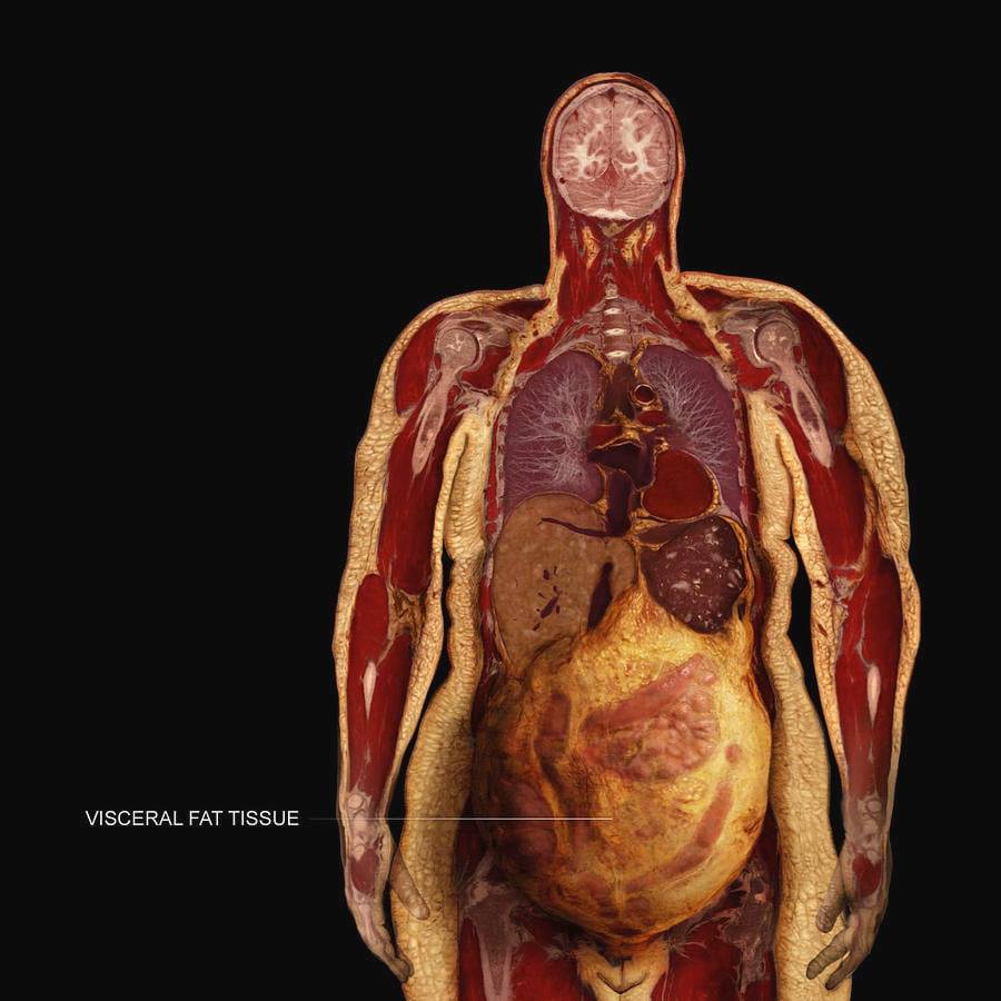 La grasa viceral